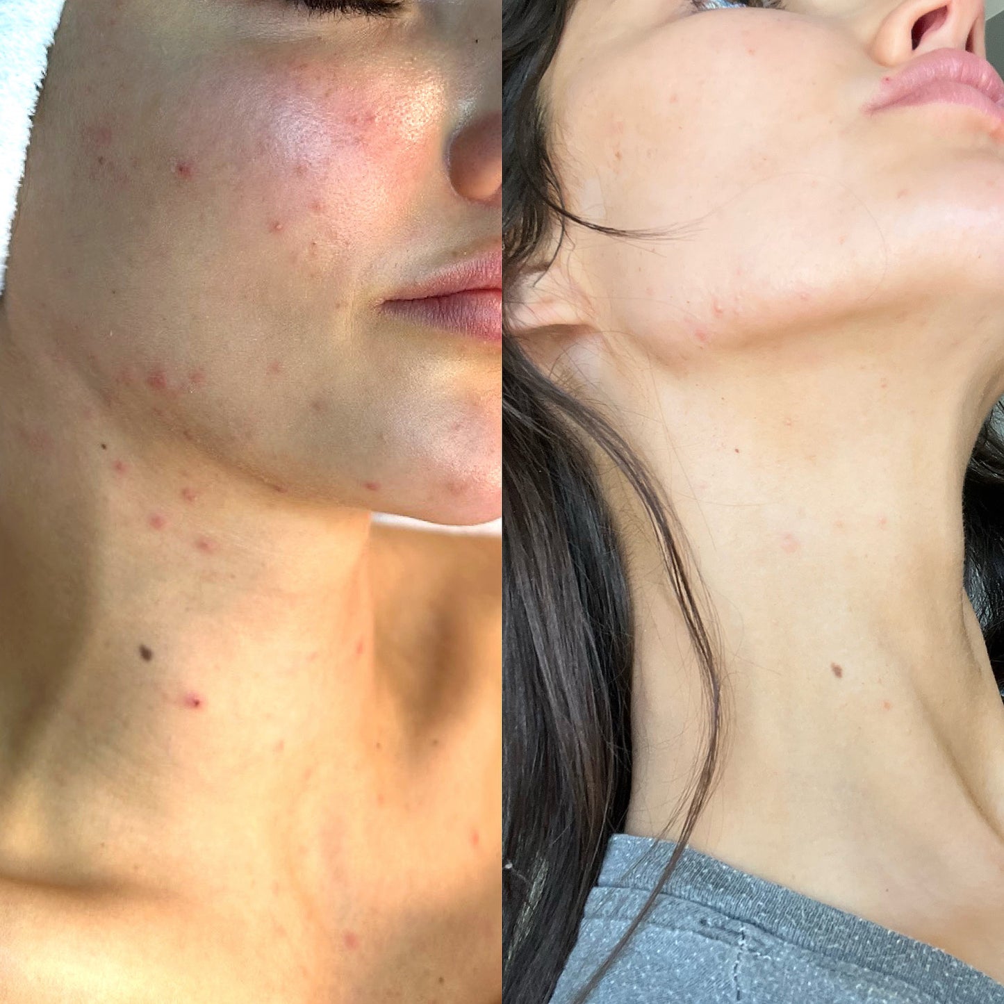 DMK ENZYME AT HOME FACIAL KIT