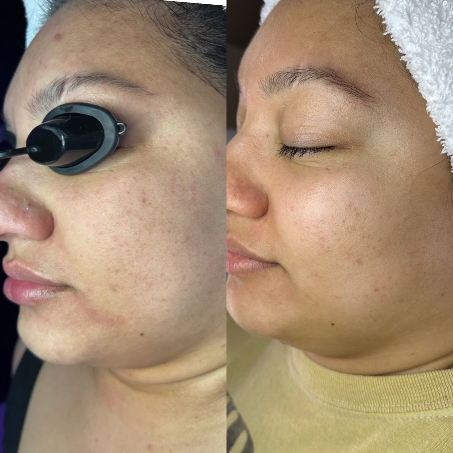 BIOCELL INTENSIVE MOISTURIZER