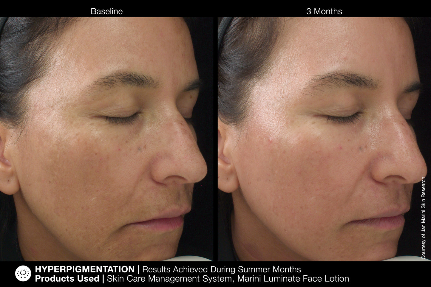 MARINI LUMINATE® FACE LOTION