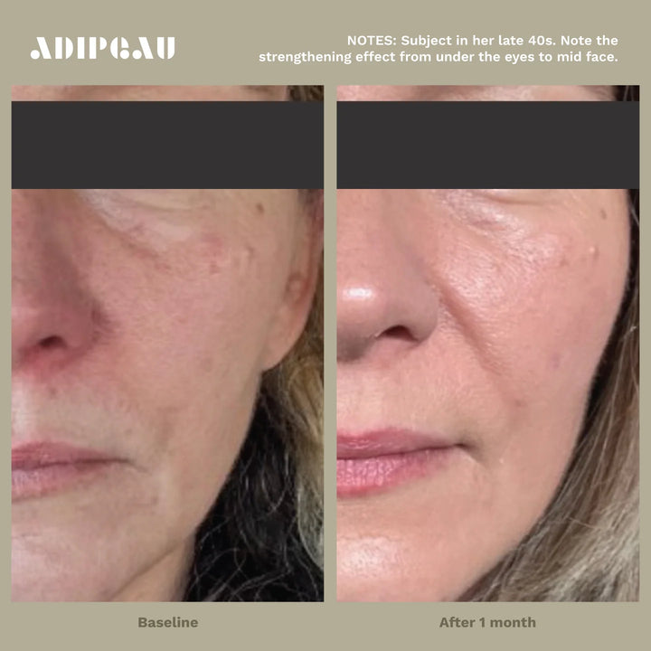 ADIPEAU STRENGTH GEL