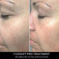 CO2Lift Pro Carboxy Gel Face Mask