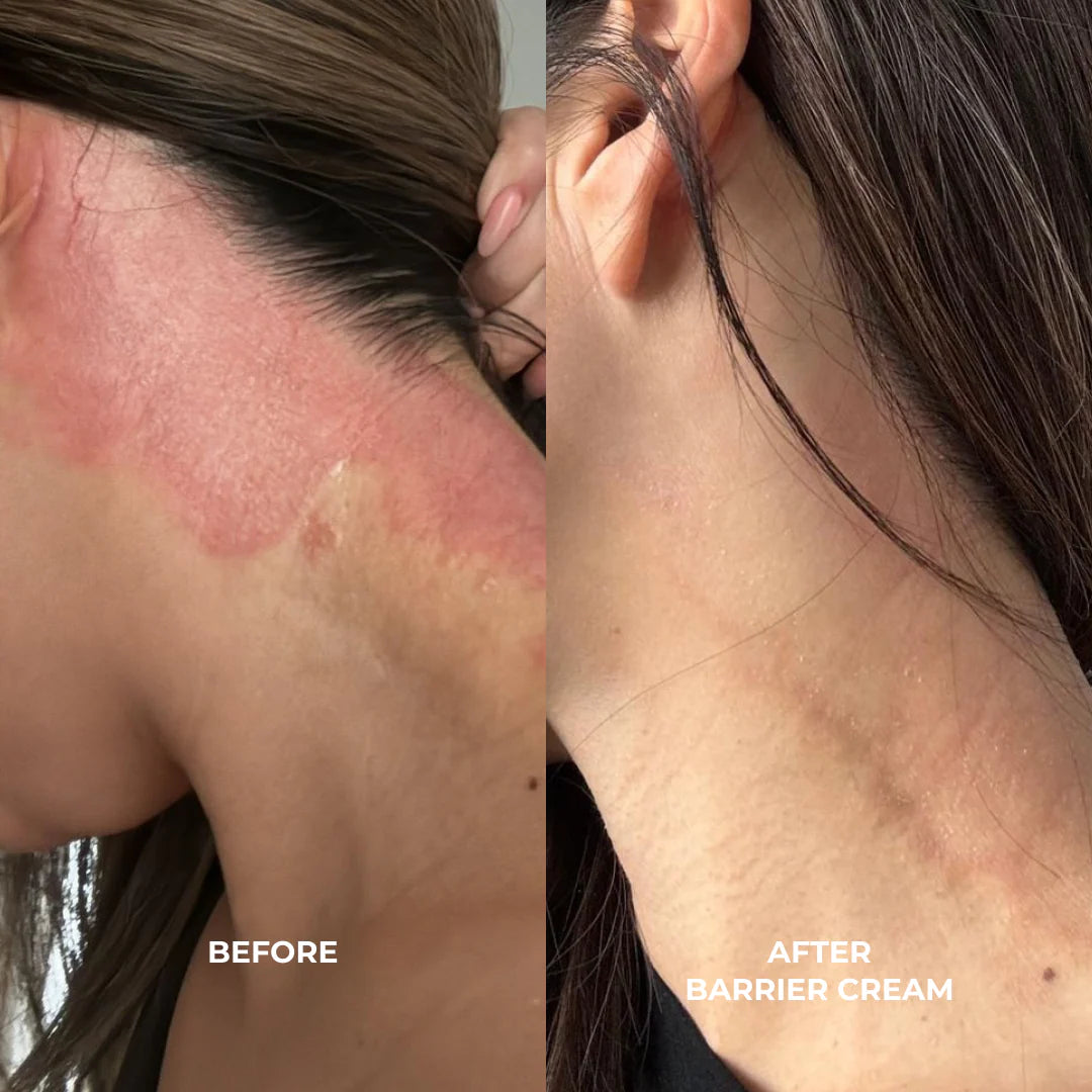 VO BARRIER REPAIR: CERAMIDES + BLUEBERRY DAILY MOISTURIZER