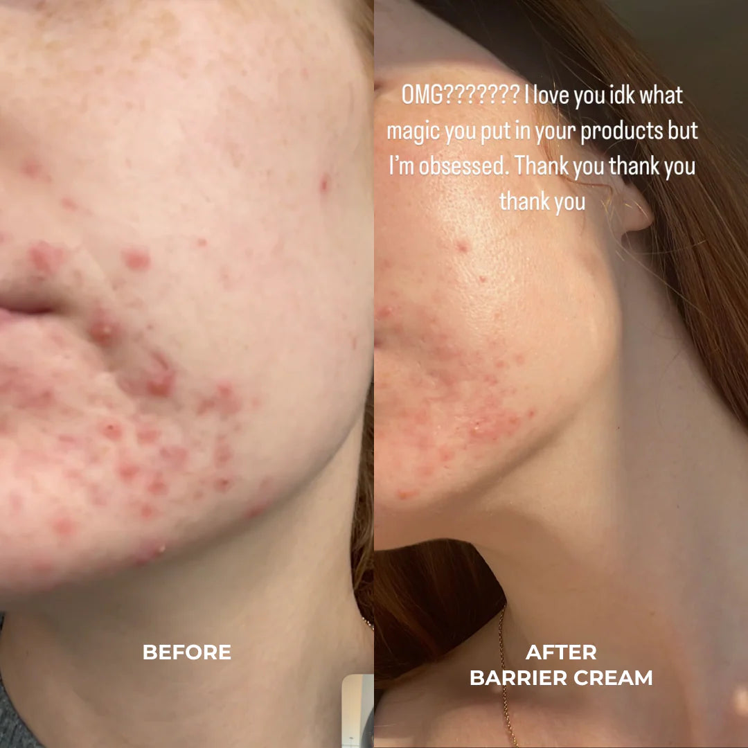 VO BARRIER REPAIR: CERAMIDES + BLUEBERRY DAILY MOISTURIZER