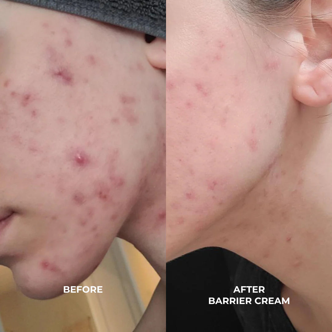 VO BARRIER REPAIR: CERAMIDES + BLUEBERRY DAILY MOISTURIZER