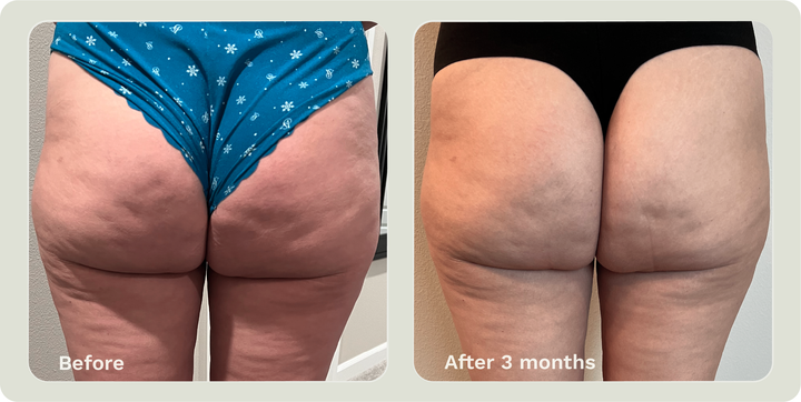 ADIPEAU STRENGTH GEL