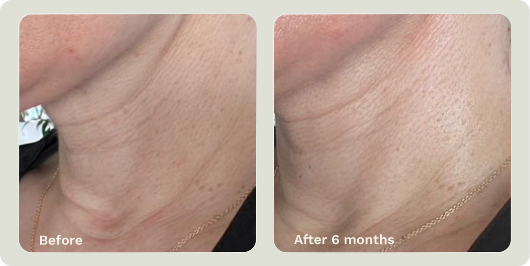 ADIPEAU STRENGTH GEL