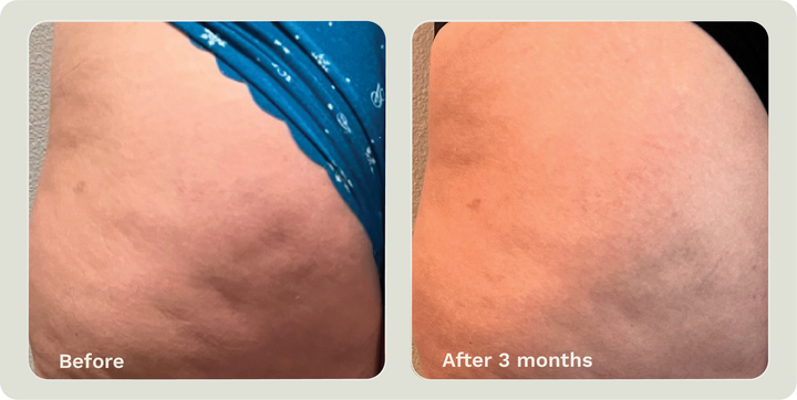 ADIPEAU STRENGTH GEL