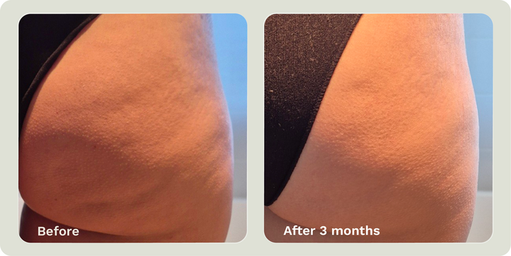 ADIPEAU STRENGTH GEL