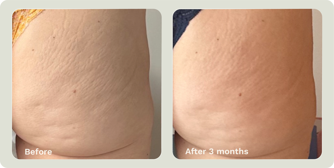 ADIPEAU STRENGTH GEL