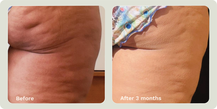 ADIPEAU STRENGTH GEL