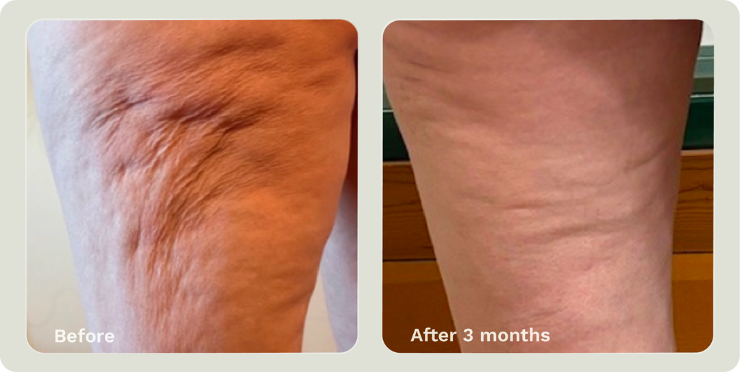 ADIPEAU STRENGTH GEL