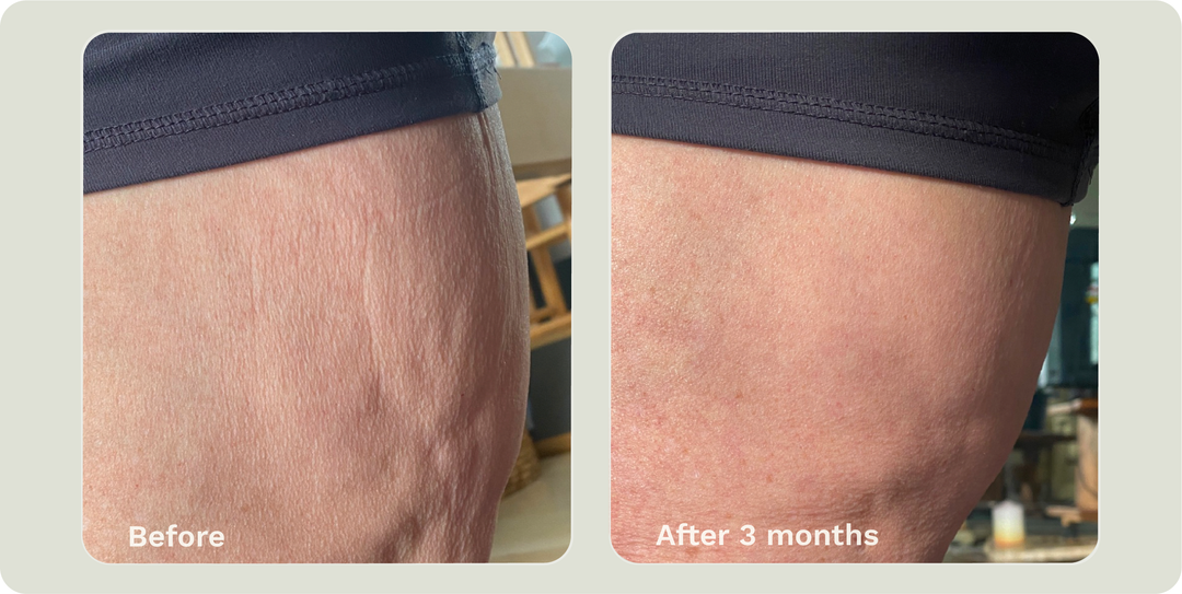 ADIPEAU STRENGTH GEL