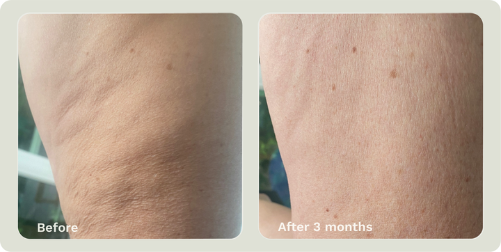 ADIPEAU STRENGTH GEL