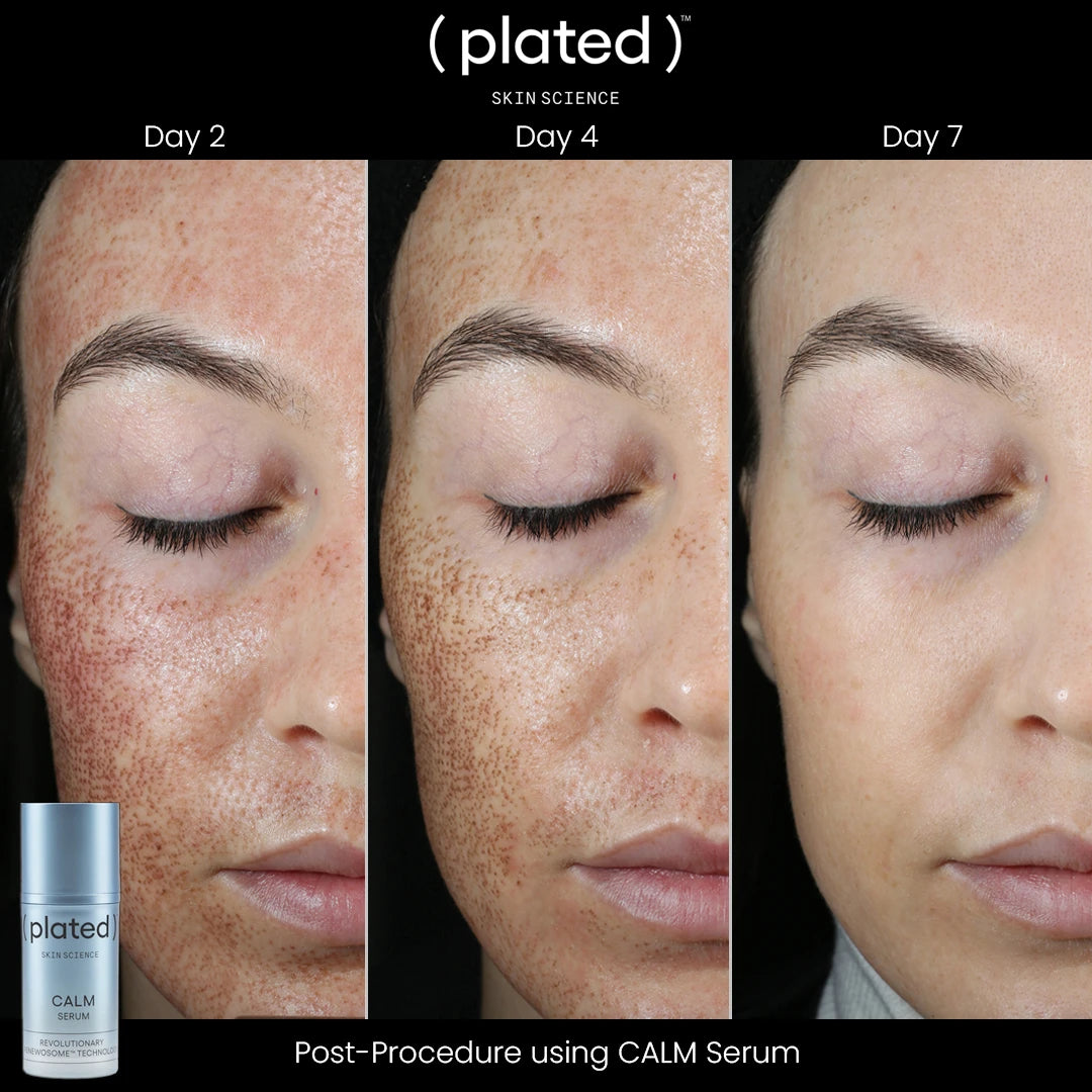 PLATED CALM SERUM