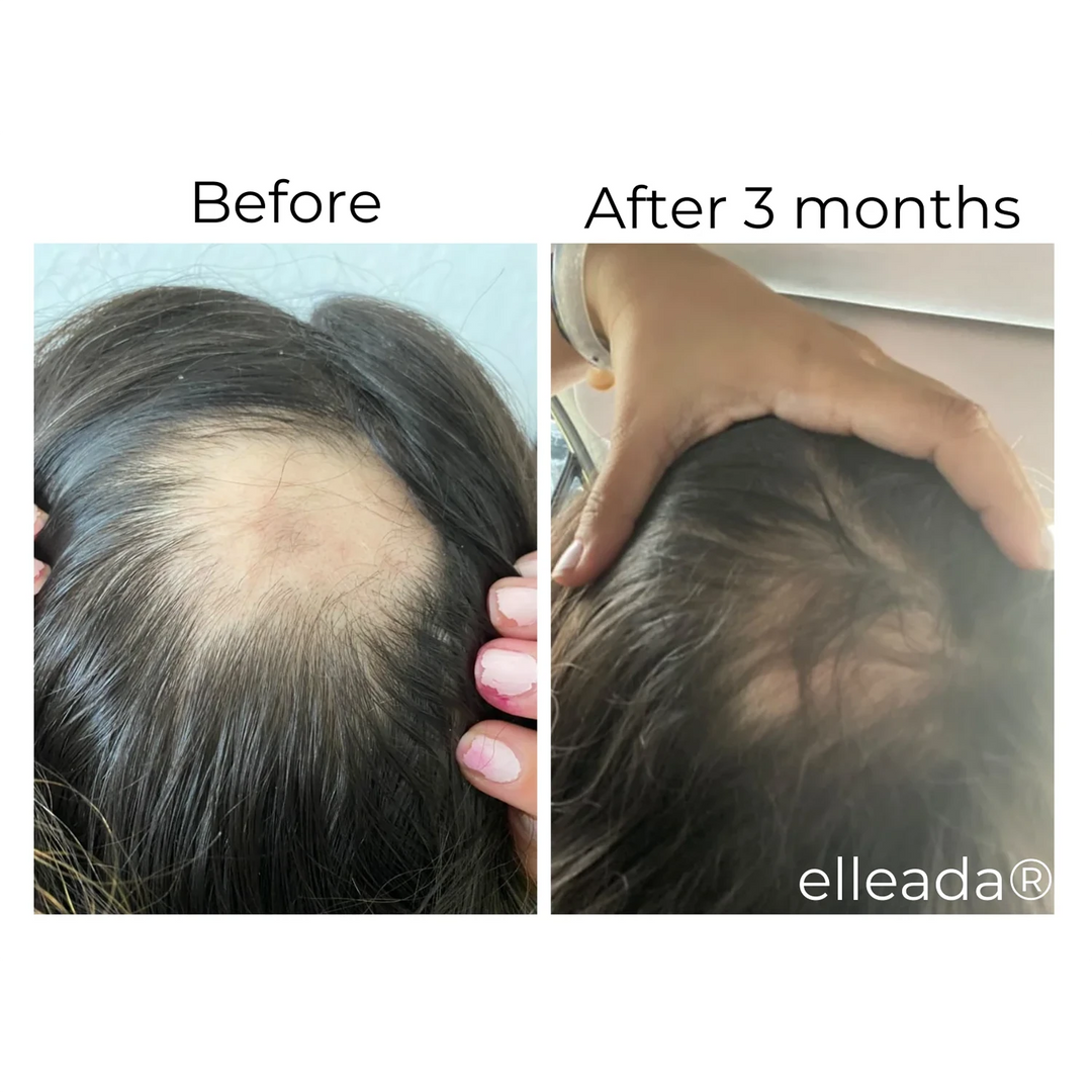 ELLEADA HAIR SERUM