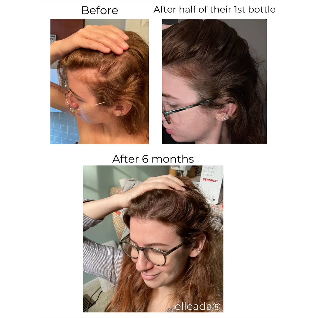 ELLEADA HAIR SERUM