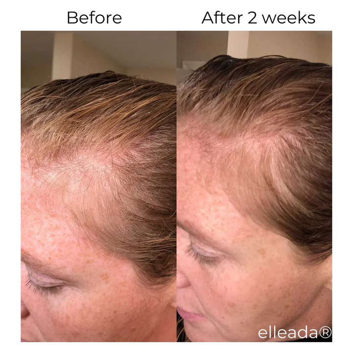 ELLEADA HAIR SERUM