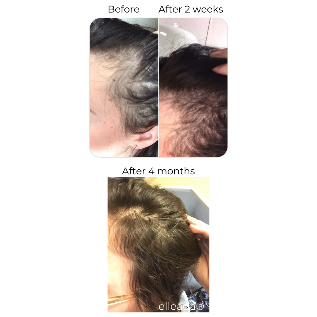 ELLEADA HAIR SERUM