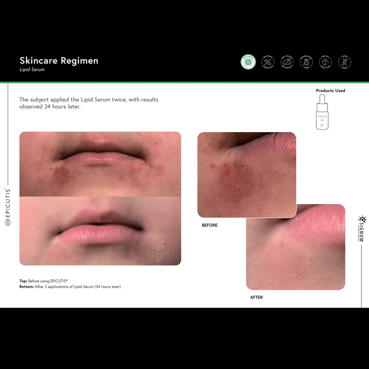 EPICUTIS LIPID SERUM
