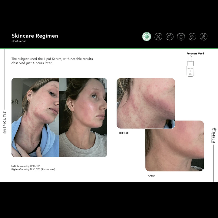 EPICUTIS LIPID SERUM