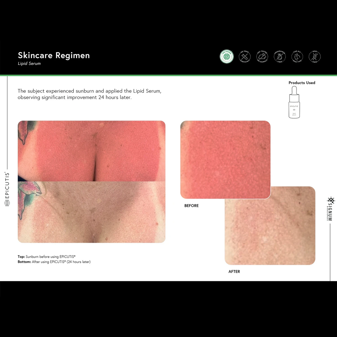 EPICUTIS LIPID SERUM