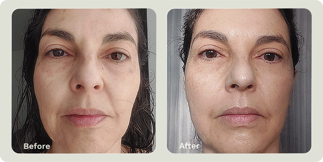 ADIPEAU VOLUME CREAM