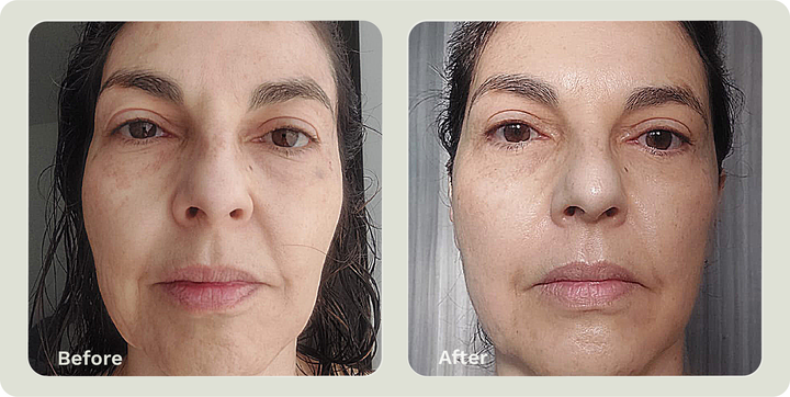 ADIPEAU VOLUME CREAM