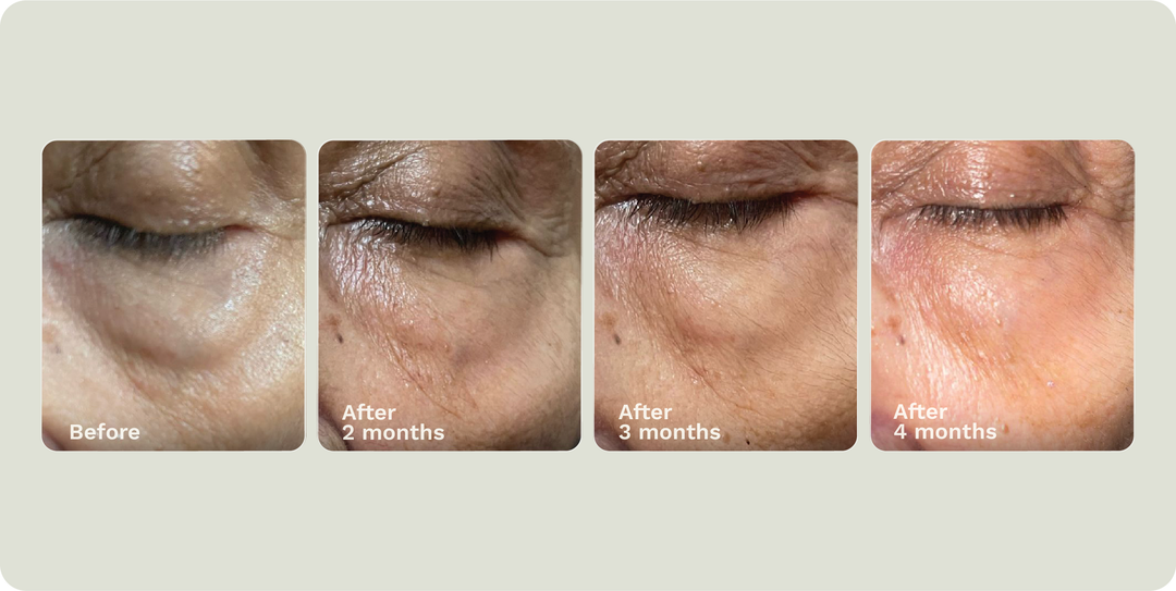 ADIPEAU VOLUME CREAM