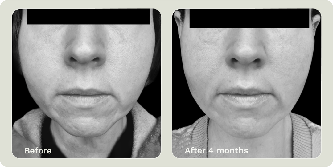 ADIPEAU VOLUME CREAM