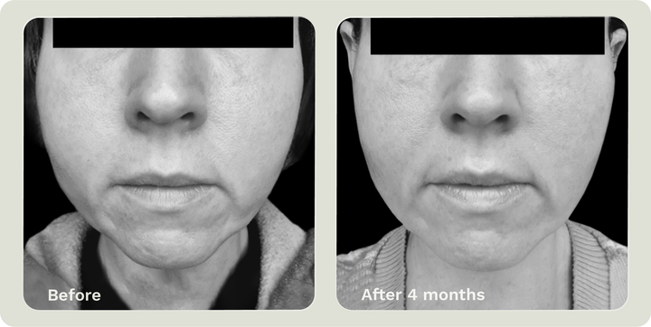 ADIPEAU VOLUME CREAM