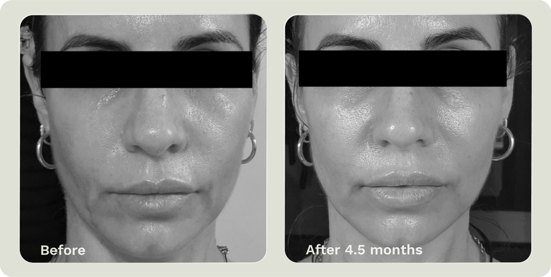 ADIPEAU VOLUME CREAM