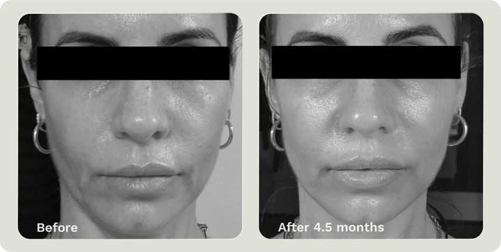 ADIPEAU VOLUME CREAM