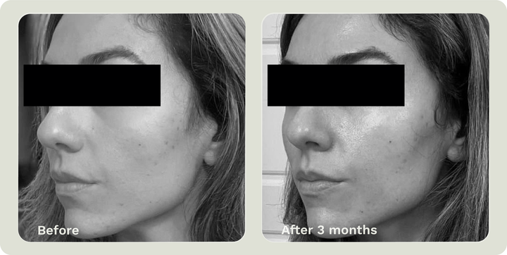 ADIPEAU VOLUME CREAM