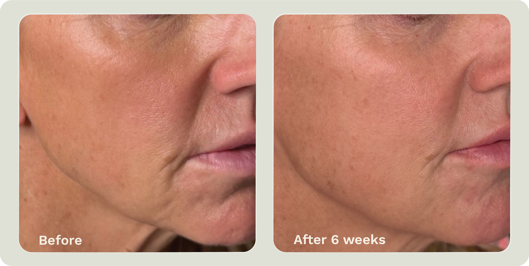 ADIPEAU VOLUME CREAM