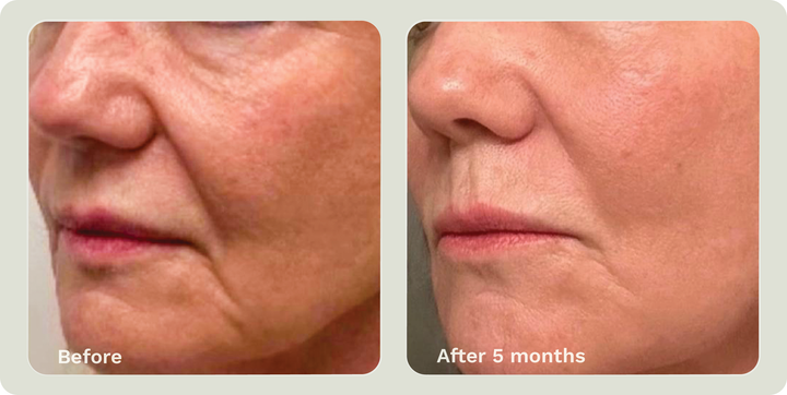 ADIPEAU VOLUME CREAM