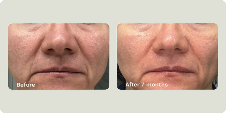 ADIPEAU VOLUME CREAM