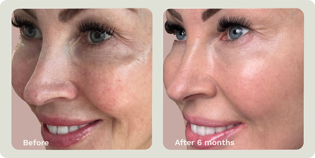 ADIPEAU VOLUME CREAM