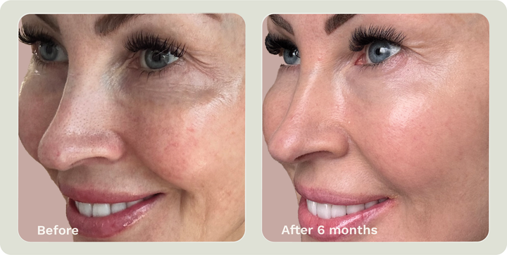 ADIPEAU VOLUME CREAM