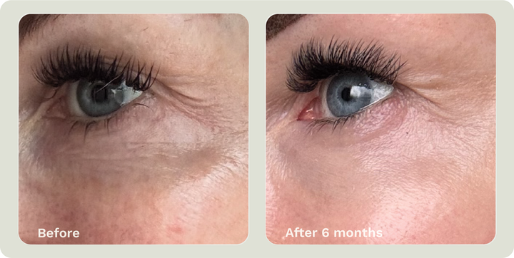 ADIPEAU VOLUME CREAM