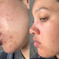 DMK ENZYME AT HOME FACIAL KIT