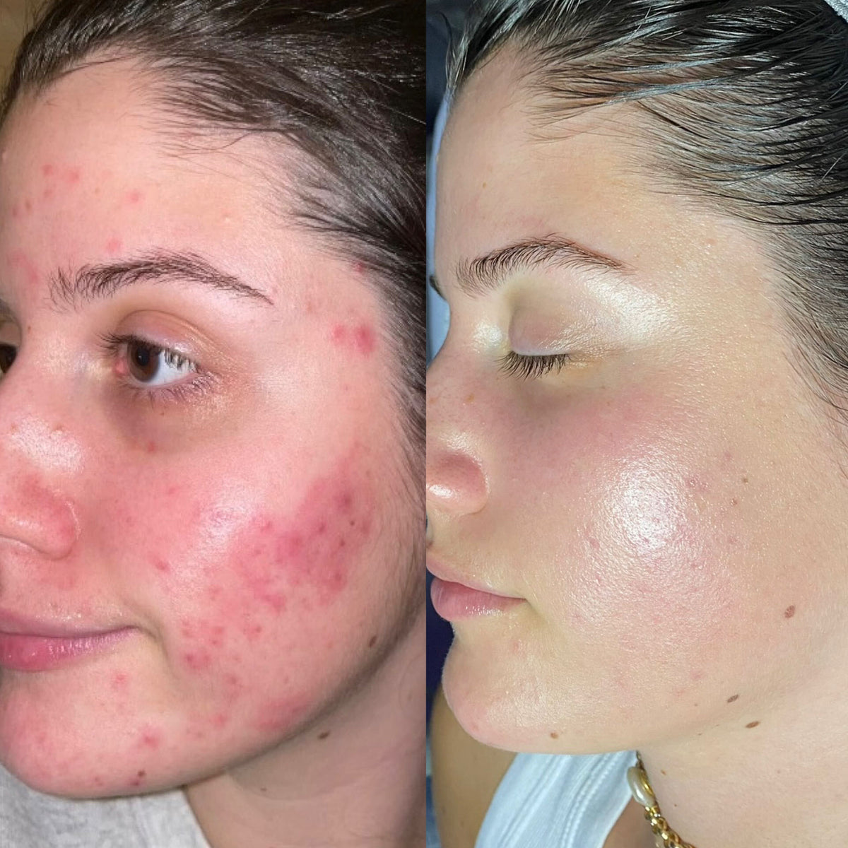 Before / after