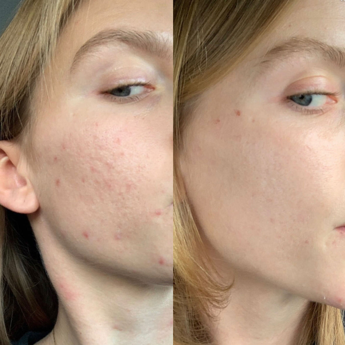 Before / after