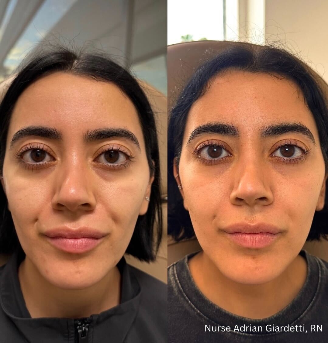 Before / after