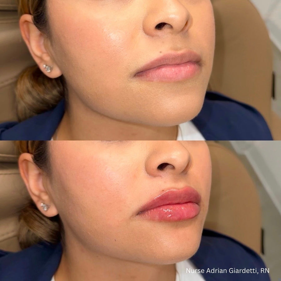Facial Balancing