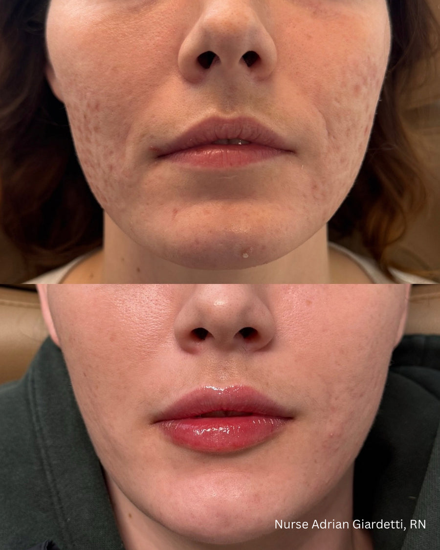 Facial Balancing