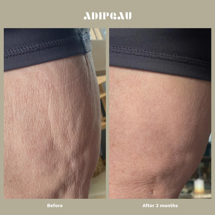 ADIPEAU STRENGTH GEL