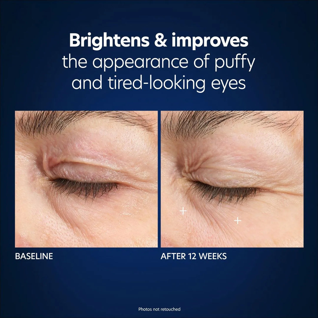 PCA HYALURONIC ACID MICRONEEDLE EYE PATCHES ( PACK of 4)