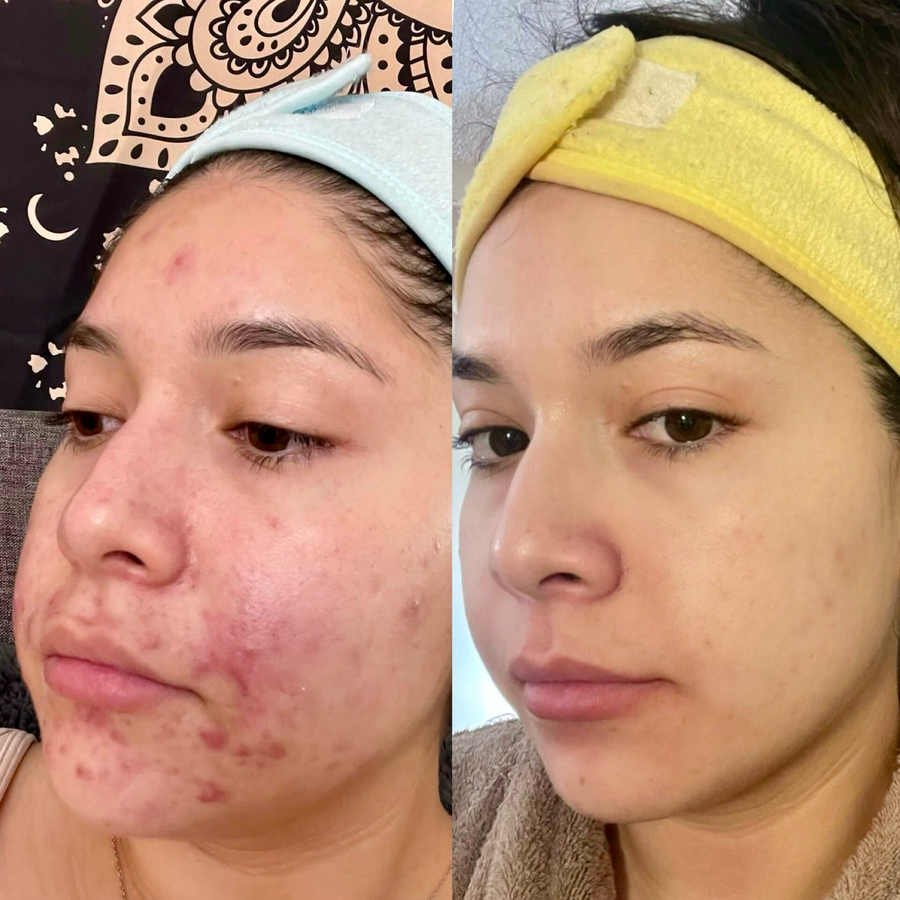 Custom Skincare Routine