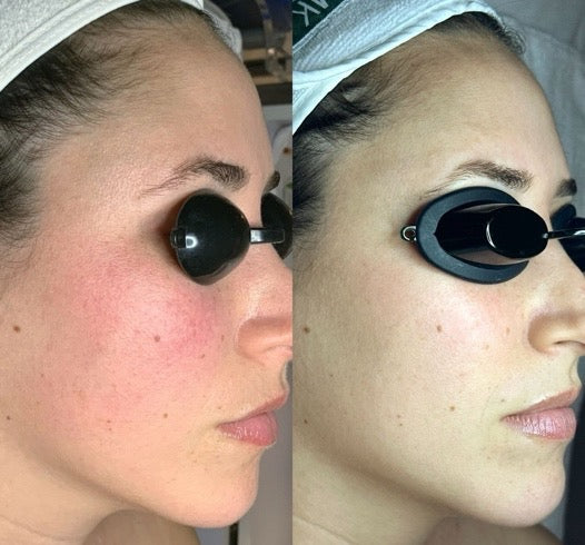  Glow Facials