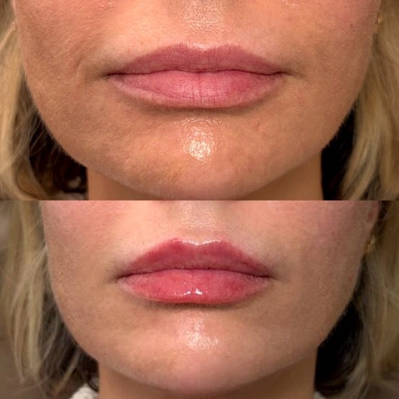 Facial Balancing